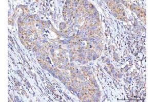 IHC analysis of C18orf22/RBFA using anti-C18orf22/RBFA antibody (ABIN7600106). (RBFA Antikörper  (AA 15-319))