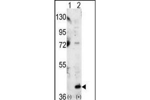 Western blot analysis of P38 (arrow) using P38 Antibody (C-term) (ABIN1882176 and ABIN2841644). (MAPK14 Antikörper  (C-Term))