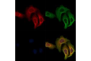 ABIN7093362 and ABIN7097382 staining Hela cells by IF/ICC. (TOMM22 Antikörper)