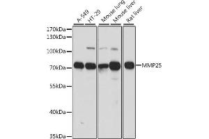 Western blot analysis of extracts of various cell lines, using MMP25 antibody (ABIN7268422) at 1:1000 dilution.