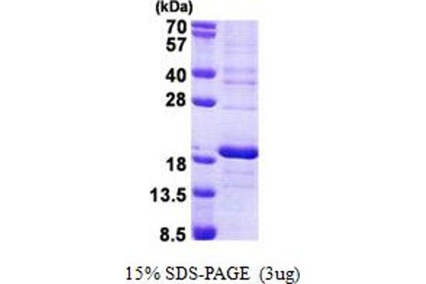 RPS16 Protein (AA 1-146) (His tag)
