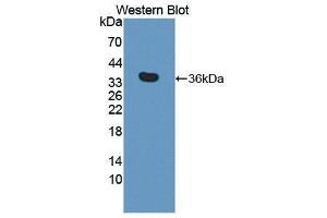 Western Blotting (WB) image for anti-tyrosine Kinase with Immunoglobulin-Like and EGF-Like Domains 1 (TIE1) (AA 835-1134) antibody (ABIN3209246) (TIE1 Antikörper  (AA 835-1134))