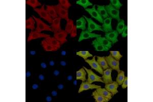 PD-L1 Mouse Monoclonal Antibody staining HepG2 cells by IF/ICC.