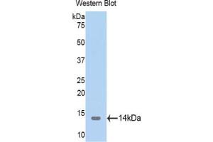 Western blot analysis of the recombinant protein. (TRX2 Antikörper  (AA 60-166))