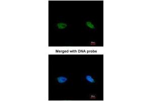 Immunofluorescence (IF) image for anti-BRCA2 and CDKN1A Interacting Protein (BCCIP) (C-Term) antibody (ABIN2856892)