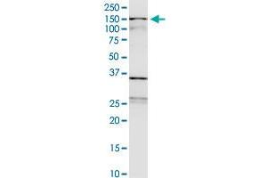 WDHD1 monoclonal antibody (M01), clone 2F10. (WDHD1 Antikörper  (AA 1031-1128))