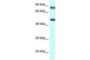 Image no. 1 for anti-Pseudouridylate Synthase 1 (PUS1) (AA 88-137) antibody (ABIN6747496)