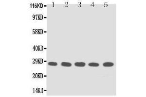 Anti-TFPI2 antibody, Western blotting Lane 1: MM453 Cell Lysate Lane 2: MM231 Cell Lysate Lane 3: HELA Cell Lysate Lane 4:  Cell Lysate Lane 5: JURKAT Cell Lysate (TFPI2 Antikörper  (Middle Region))