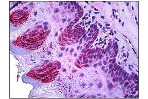 Human Squamous Epithelium: Formalin-Fixed, Paraffin-Embedded (FFPE) (TSPO Antikörper  (C-Term))