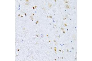 Immunohistochemistry of paraffin-embedded mouse spinal cord using ZEB2 antibody (ABIN5973336) at dilution of 1/100 (40x lens). (ZEB2 Antikörper)