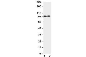 Western blot testing of EPB41L1 antibody and Lane 1:  rat brain;  2: mouse brain lysate. (EPB41L1 Antikörper  (C-Term))