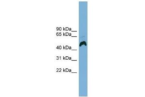 Western Blotting (WB) image for anti-ATPase, H+ Transporting, Lysosomal Accessory Protein 1 (ATP6AP1) (Middle Region) antibody (ABIN2782118)