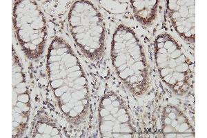 Immunostaining (ISt) image for anti-Proteasome (Prosome, Macropain) Subunit, beta Type, 8 (Large Multifunctional Peptidase 7) (PSMB8) (AA 173-272) antibody (ABIN562483)