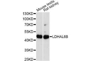 Western blot analysis of extracts of various cell lines, using LDHAL6B antibody.