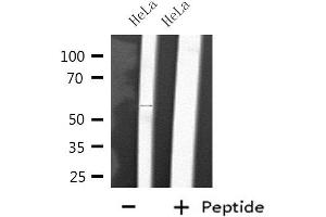 Western blot analysis of extracts from HeLa cells, using CYP2D6 antibody. (CYP2D6 Antikörper)