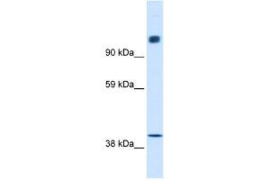WB Suggested Anti-NCOR1 Antibody Titration:  0. (NCOR1 Antikörper  (N-Term))