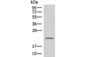 Western blot analysis of Human fetal liver tissue lysate using IFNA8 Polyclonal Antibody at dilution of 1:500 (IFNA8 Antikörper)