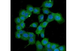 IF analysis of PPID using anti-PPID antibody (ABIN6719438).