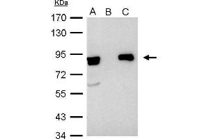 IP Image Ku80(XRCC5) antibody immunoprecipitates Ku80 protein in IP experiments. (X-Ray Repair Cross Complementing 5 Antikörper)
