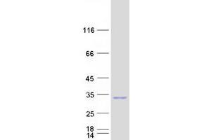 Validation with Western Blot (RND3 Protein (Myc-DYKDDDDK Tag))