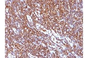Formalin-fixed, paraffin-embedded human tonsil stained with SUMO-1 antibody (SUMO1/1188) (SUMO1 Antikörper)