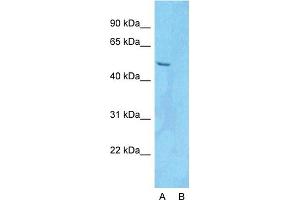 Western Blotting (WB) image for anti-PDZ and LIM Domain 5 (PDLIM5) (N-Term) antibody (ABIN2780775)