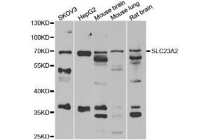 Western blot analysis of extracts of various cell lines, using SLC23A2 antibody. (SLC23A2 Antikörper)
