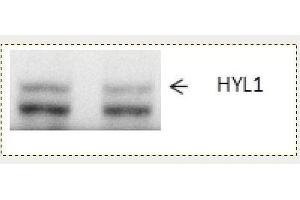 Western Blotting (WB) image for anti-Epoxide Hydrolase 1, Microsomal (Xenobiotic) (EPHX1) antibody (ABIN334544) (EPHX1 Antikörper)