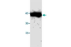 Western blot analysis in CTSH recombinant protein with CTSH monoclonal antibody, clone 69s45  at 1 : 1000 dilution. (Cathepsin H Antikörper)