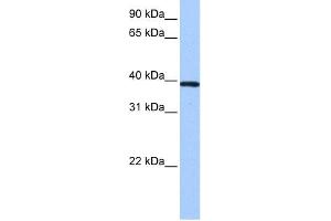 WB Suggested Anti-ZNF618 Antibody Titration:  0. (ZNF618 Antikörper  (N-Term))