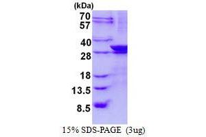 Lin-7 Homolog A (LIN7A) (AA 1-233) protein (His tag)