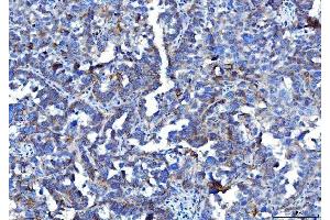 IHC analysis of Poliovirus Receptor/PVR using anti-Poliovirus Receptor/PVR antibody (ABIN7601072). (Poliovirus Receptor Antikörper  (AA 28-331))