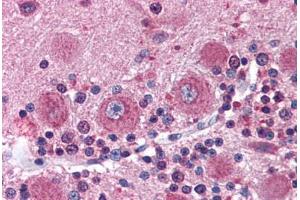 Human Brain, Cerebellum (formalin-fixed, paraffin-embedded) stained with DISC1 antibody ABIN337351 at 10 ug/ml followed by biotinylated goat anti-rabbit IgG secondary antibody ABIN481713, alkaline phosphatase-streptavidin and chromogen. (DISC1 Antikörper  (C-Term))