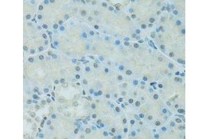 Immunohistochemistry of paraffin-embedded Rat kidney using CEBPA Polyclonal Antibody at dilution of 1:100 (40x lens). (CEBPA Antikörper)