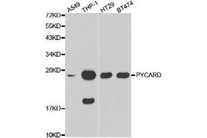 Western blot analysis of extracts of various cell lines, using PYCARD antibody. (PYCARD Antikörper  (AA 50-195))
