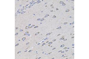 Immunohistochemistry of paraffin-embedded rat brain using TMC1 antibody (ABIN5996250) at dilution of 1/100 (40x lens). (TMC1 Antikörper)