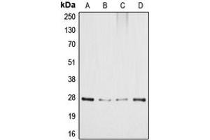 Western blot analysis of GADD153 expression in HeLa (A), MCF7 (B), SP2/0 (C), PC12 (D) whole cell lysates.