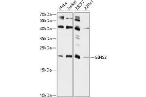 Western blot analysis of extracts of various cell lines, using GINS2 antibody (ABIN6131700, ABIN6141087, ABIN6141088 and ABIN6224916) at 1:1000 dilution. (GINS2 Antikörper  (AA 1-185))