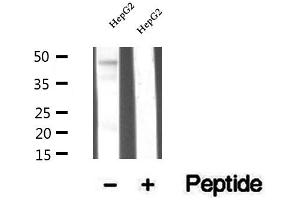 Western blot analysis of extracts of HepG2 cells, using TRBP antibody. (TARBP2 Antikörper  (Internal Region))