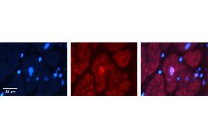 Rabbit Anti-BUB3 Antibody Catalog Number: ARP58599_P050 Formalin Fixed Paraffin Embedded Tissue: Human heart Tissue Observed Staining: Nucleus Primary Antibody Concentration: 1:100 Other Working Concentrations: N/A Secondary Antibody: Donkey anti-Rabbit-Cy3 Secondary Antibody Concentration: 1:200 Magnification: 20X Exposure Time: 0. (BUB3 Antikörper  (N-Term))