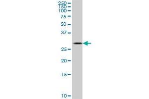 TGIF2 monoclonal antibody (M03), clone 5G1. (TGIF2 Antikörper  (AA 131-236))