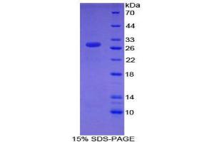 SDS-PAGE (SDS) image for Chromodomain Helicase DNA Binding Protein 3 (CHD3) (AA 1613-1820) protein (His tag) (ABIN1878860) (CHD3 Protein (AA 1613-1820) (His tag))