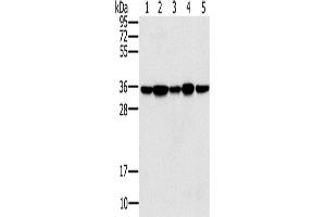 Western Blotting (WB) image for anti-Protein Phosphatase 1, Catalytic Subunit, gamma Isoform (PPP1CC) antibody (ABIN5550180) (PPP1CC Antikörper)