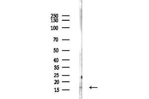 anti-Ribosomal Protein S23 (RPS23) (N-Term) antibody