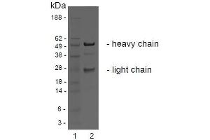 SDS-PAGE analysis of purified BBX-1H1 monoclonal antibody. (LGR4 Antikörper)