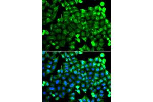 Immunofluorescence analysis of A549 cell using NCALD antibody. (NCALD Antikörper)