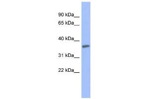 WB Suggested Anti-PRKCG Antibody Titration: 0. (PKC gamma Antikörper  (Middle Region))
