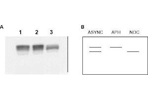 Image no. 1 for anti-Minichromosome Maintenance Complex Component 2 (MCM2) (AA 21-31) antibody (ABIN401335) (MCM2 Antikörper  (AA 21-31))