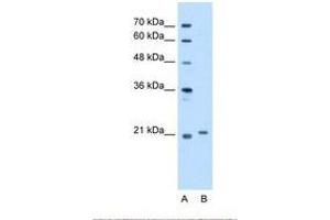 Image no. 1 for anti-Titin-Cap (Telethonin) (TCAP) (C-Term) antibody (ABIN321410) (TCAP Antikörper  (C-Term))