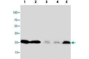 Western blot analysis of tissue and cell extracts with PTN polyclonal antibody . (Pleiotrophin Antikörper  (C-Term))